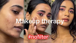 MAKEUP THERAPY | *NO FILTER*| Acne | My skin reality | Pigmentation | Brown Skin | Relaxing