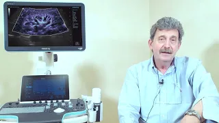 Renal Artery Examination Protocol - Prof. Fabrizio Calliada