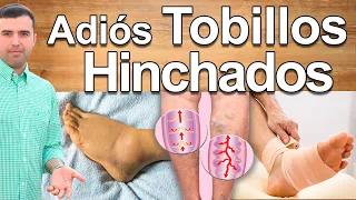 Cómo Eliminar Los Tobillos Hinchados - Cómo Quitar La Hinchazón de Pies, Retención De Líquidos