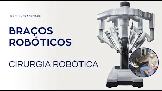 Braços robóticos - Cirurgia Robótica na Urologia -  Dr. Hiury Silva Andrade