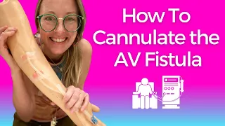 Dialysis Nursing: How to Cannulate the AV FISTULA