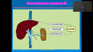 ПОРТАЛЬНАЯ ГИПЕРТЕНЗИЯ