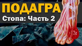 Стопа - Часть 2 - Подагра [S05E24]