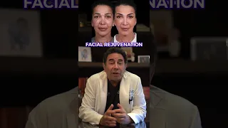 Facial Rejuventation with Rhinoplasty | Dr. Paul Nassif