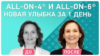 Можно ли вернуть все зубы сразу? 👉 отзыв пациентки о новых технологиях в области протезирования