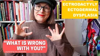 My Disability | EEC Syndrome / Ectodermal Dysplasia