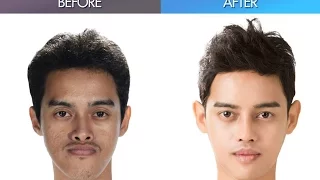 Let Me In Thailand, and the amazing plastic surgery makeover by Korean doctors!