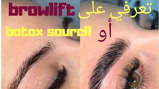 تعرفي على browlift أو botox sourcil لإبراز جمال وجهكِ وعينيك