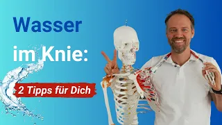 Warum schwillt mein Knie an? ➡️ 2 konkrete Tipps gegen Wasser im Arthrose-Knie