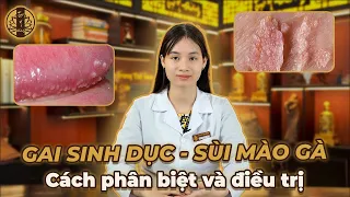 PHÂN BIỆT GAI SINH DỤC VÀ SÙI MÀO GÀ - DẤU HIỆU ĐẶC TRƯNG NHẬN DIỆN SÙI MÀO GÀ VÀ GAI SINH DỤC