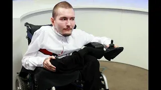 The World's First Head Transplant