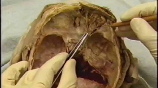 Forensic Medicine: Human Head and Neck Autopsy and Dissection Explained in Details Part-3