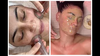 ASMR Spa Facial {Brighten Dark Spots, Cupping, Dermaplaning, Sleep Meditation} MUST WATCH!