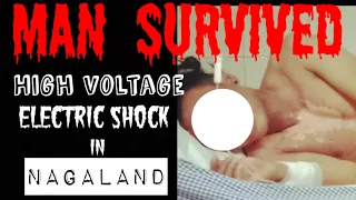 This man survived high VOLTAGE current.