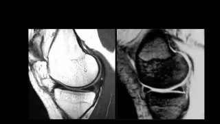 Imaging of Knee joint I jordan Aug 2014   Dr Mamdouh Mahfouz In Arabic