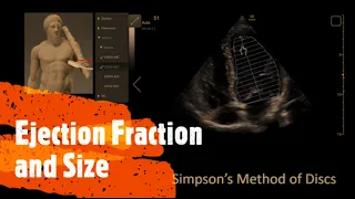 Measure  Ejection Fraction (EF) and Ventricle Size. Perioperative & Critical Care ECHO / POCUS