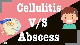 Difference between Cellulitis and Abscess I Cellulitis v/s Abscess