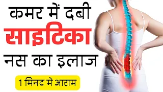 कमर मे दबी साइटिका नस का इलाज | कमर दर्द | पैरो मै सुनपन | Disc bulge | SCIATICA | पैरो मै दर्द