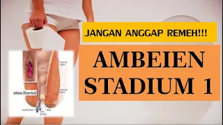 CIRI-CIRI AMBEIEN STADIUM 1 DAN CARA MENANGANINYA | OBAT ALAMI AMBEIEN TANPA EFEK SAMPING |