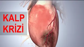 Kalp Krizi