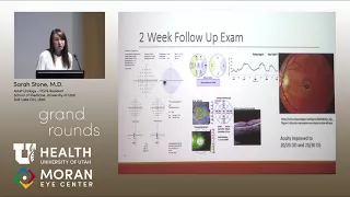 Neuroretinitis