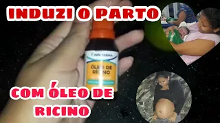 INDUZI MEU PARTO COM ÓLEO DE RICINO/COMO INDUZIR PARTO COM ÓLEO DE RICINO/