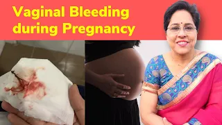 Bleeding During Pregnancy | Spotting in Pregnancy | Pregnancy Symptoms | iMumz