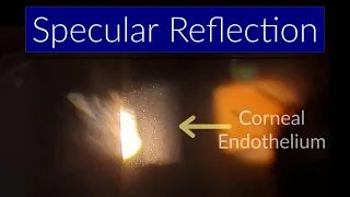 Specular Reflection - Slit Lamp Techniques