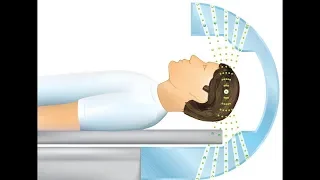 Gamma Knife Treatment for Essential Tremor