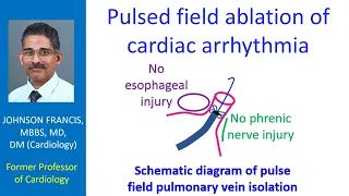 Pulsed field ablation of cardiac arrhythmia