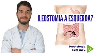 Existe ileostomia do lado esquerdo da barriga?