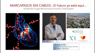 Marcapasos sin cables explicados por el Dr. Ruyra