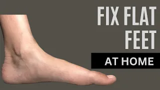 Did You have flat feet? Do these five simple exercises.