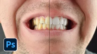 Photoshop Teeth Whitening Tutorial - Fix Yellow Teeth in photos