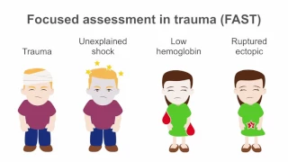Understanding Point of Care Ultrasound (POCUS) in trauma assessment - EFAST BASICS