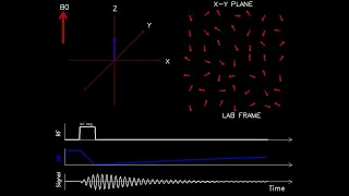 MRI: Physics and Image Creation - T1 and T2 Relaxation (Part 10/18)