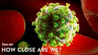 How Close Are We to Curing HIV/AIDS?