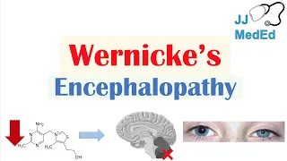 Wernicke’s Encephalopathy | Causes, Symptom Triad & Treatment