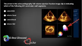 All About Ultrasound: 3d Echo Volume