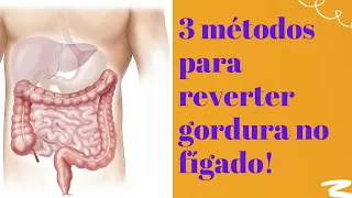 3 métodos infalíveis para reverter gordura no fígado! | Dr. Marco Menelau