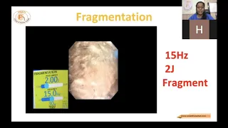 60W Thulium Fibre Laser Settings (TFL)