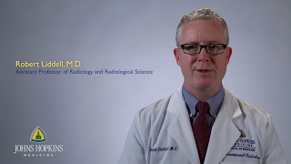 Dr. Robert Liddell | Interventional Radiology