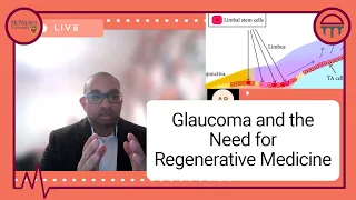 Glaucoma and the Need for Regenerative Medicine