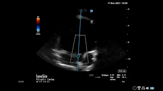 How to...Measure AV VTI