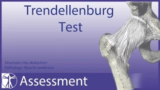 Trendelenburg Test | Hip Abductor Weakness