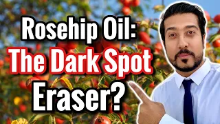 Rosehip Oil for Dark Spots in Melasma and Hyperpigmentation