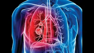 Asthma , TB & Lung Diseases - Part 2