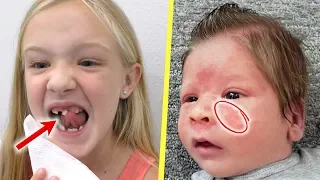 Trinity Loses Her Tooth and Preston's Rare Baby Skin Rash!!