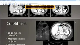 Clase 16 TC (9 - 12)