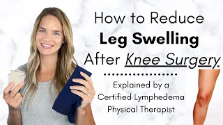 How to Reduce Leg Swelling After Knee Surgery - By a Physical Therapist